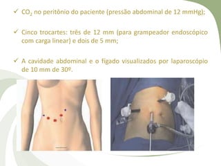  CO2 no peritônio do paciente (pressão abdominal de 12 mmHg);
 Cinco trocartes: três de 12 mm (para grampeador endoscópico
com carga linear) e dois de 5 mm;
 A cavidade abdominal e o fígado visualizados por laparoscópio
de 10 mm de 30º.
 