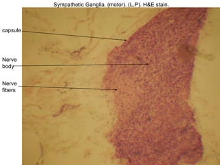 Sympathetic Ganglia. (motor). (L.P). H&E stain.
Nerve
body
capsule
Nerve
fibers
 