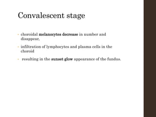 Convalescent stage
• choroidal melanocytes decrease in number and
disappear,
• infiltration of lymphocytes and plasma cells in the
choroid
• resulting in the sunset glow appearance of the fundus.
 