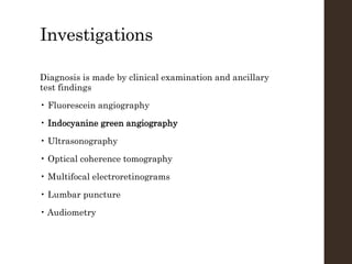 Investigations
Diagnosis is made by clinical examination and ancillary
test findings
• Fluorescein angiography
• Indocyanine green angiography
• Ultrasonography
• Optical coherence tomography
• Multifocal electroretinograms
• Lumbar puncture
• Audiometry
 