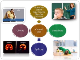 Central
uses
Attention
deficit
hyperkinetic
disorder
(ADHD):
Narcolepsy
Epilepsy
Obesity
 