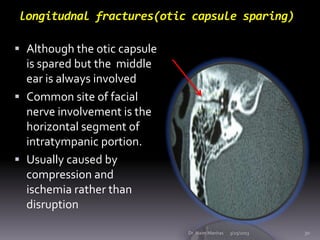longitudnal fractures(otic capsule sparing)

 Although the otic capsule
  is spared but the middle
  ear is always involv...