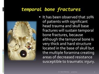 temporal bone fractures
       It has been observed that 20%
        of patients with significant
        head trauma and...