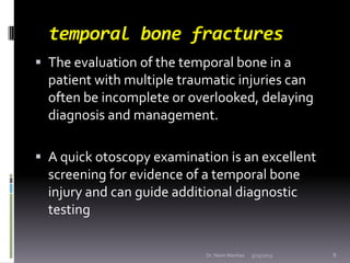temporal bone fractures
 The evaluation of the temporal bone in a
  patient with multiple traumatic injuries can
  often ...
