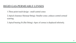 Symposium ectasia of cornea, keratonus, pmd, tmd | PDF
