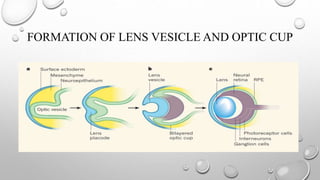 FORMATION OF LENS VESICLE AND OPTIC CUP
 