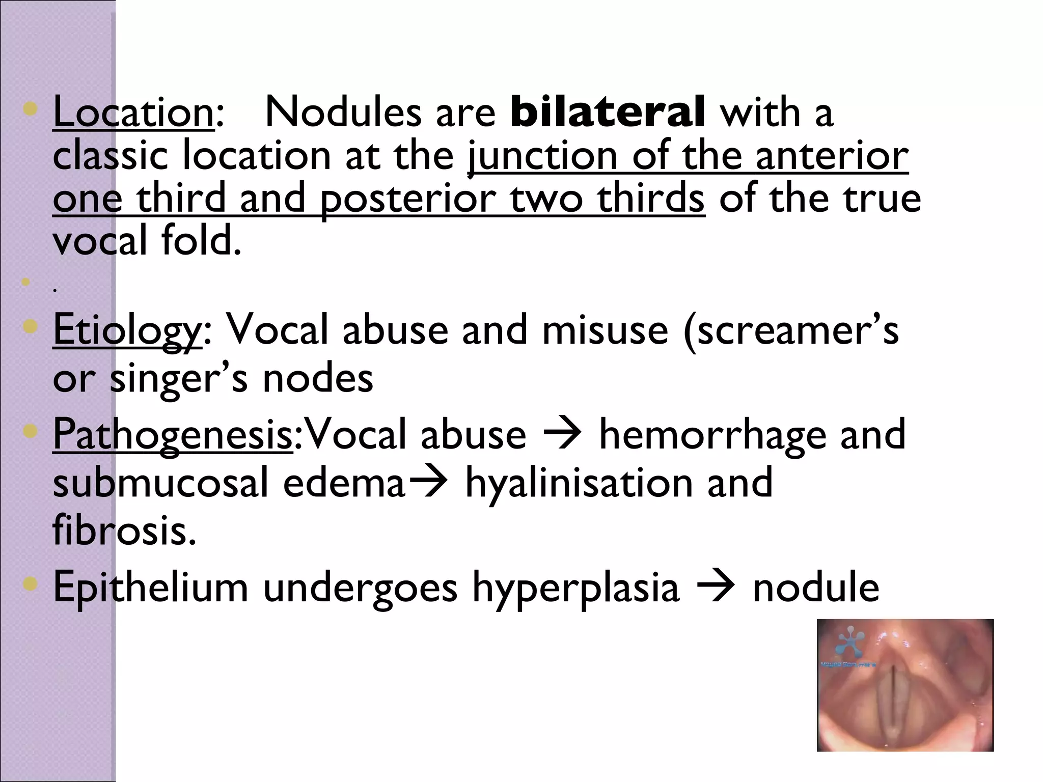 Location :  Nodules are  bilateral  with a classic location at the  junction of the  anterior one third and posterior two thirds   of the true vocal fold.  .   Etiology : Vocal abuse and misuse (screamer’s or singer’s nodes Pathogenesis :Vocal abuse    hemorrhage and submucosal edema   hyalinisation and fibrosis. Epithelium undergoes hyperplasia    nodule 