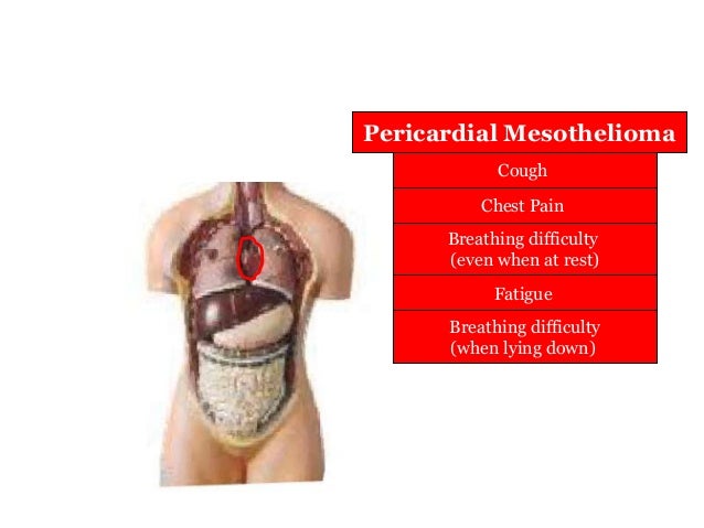 biphasic malignant peritoneal mesothelioma