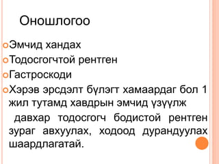 Эмчид хандах
Тодосгогчтой рентген
Гастроскоди
Хэрэв эрсдэлт бүлэгт хамаардаг бол 1
жил тутамд хавдрын эмчид үзүүлж
давхар тодосгогч бодистой рентген
зураг авхуулах, ходоод дурандуулах
шаардлагатай.
Оношлогоо
 