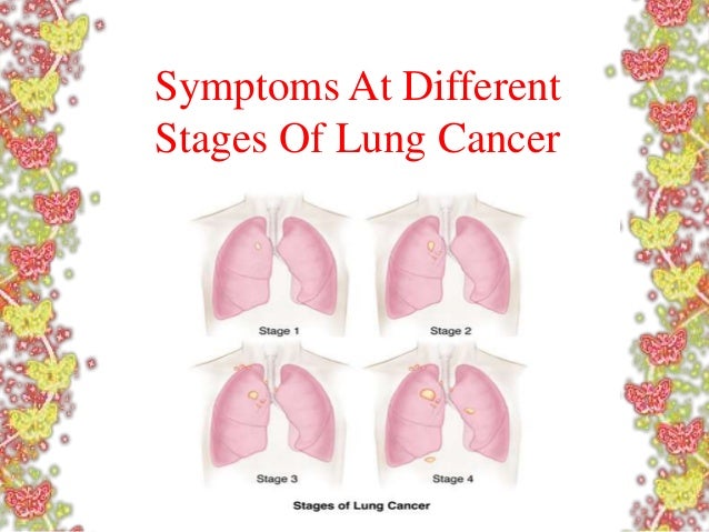 Symptoms At Different Stages Of Lung Cancer