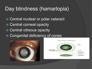 Day blindness (hamarlopia)
 Central nuclear or polar cataract
 Central corneal opacity
 Central vitreous opacity
 Congenital deficiency of cones
 