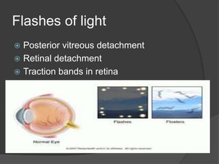 Flashes of light
 Posterior vitreous detachment
 Retinal detachment
 Traction bands in retina
 