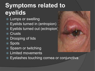 Symptoms related to
eyelids
 Lumps or swelling
 Eyelids turned in (entropion)
 Eyelids turned out (ectropion)
 Crusts
 Drooping of lids
 Spots
 Spasm or twitching
 Limited movements
 Eyelashes touching cornea or conjunctiva
 