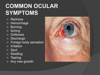 COMMON OCULAR
SYMPTOMS
 Redness
 Hemorrhage
 Burning
 Itching
 Grittiness
 Discharge
 Foreign body sensation
 Irritation
 Spot
 Swelling
 Tearing
 Any new growth
 