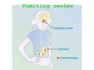Vomiting center
 
