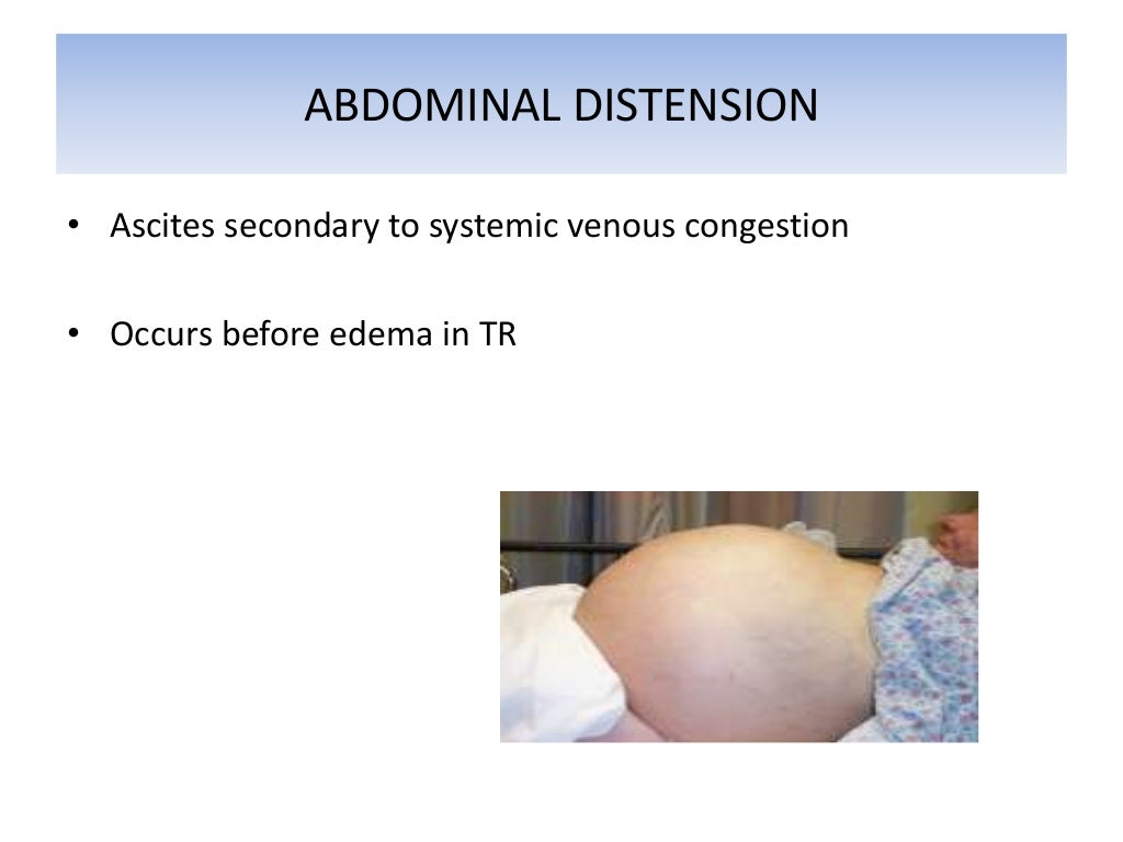 Symptoms of CARDIOVASCULAR DISEASES