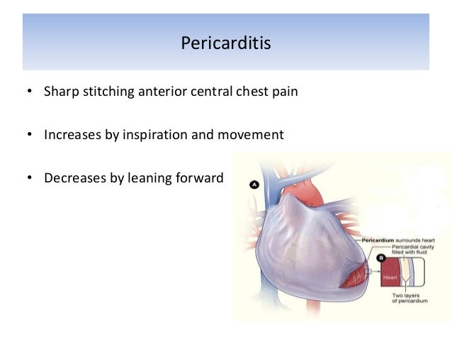 Symptoms Of CARDIOVASCULAR DISEASES symptoms-of-cardiovascular-diseases