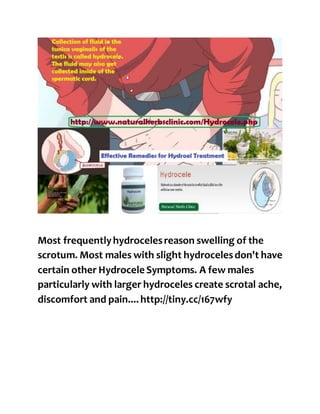Most frequentlyhydrocelesreason swelling of the
scrotum. Most males with slight hydrocelesdon't have
certain other Hydrocele Symptoms. A few males
particularly with larger hydroceles create scrotal ache,
discomfort and pain.... http://tiny.cc/167wfy
 