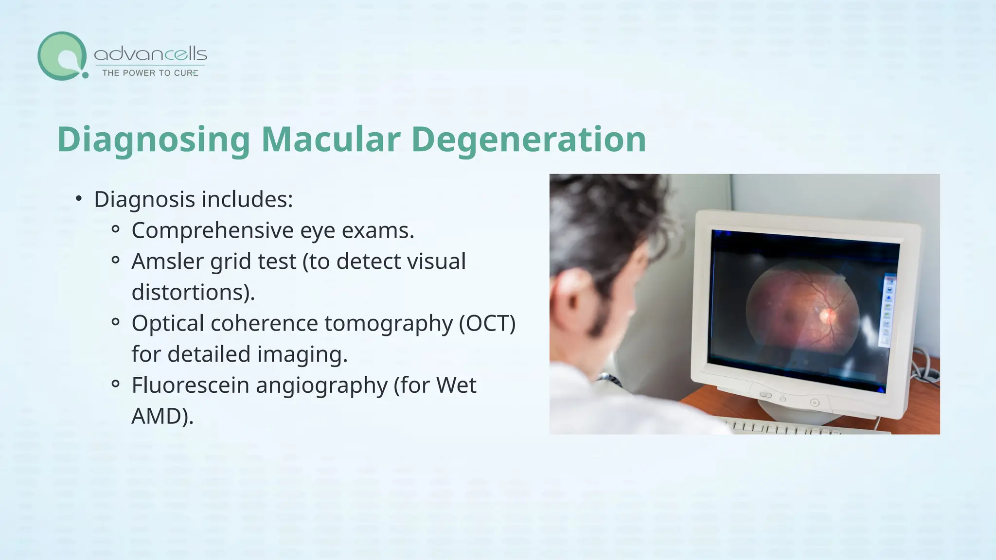 Symptoms of Macular Degeneration and Age-Related Macular Degeneration ...