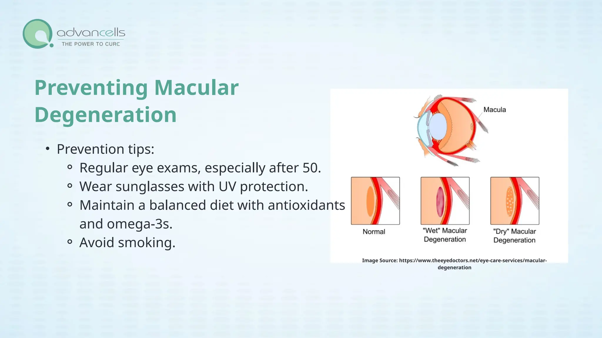Symptoms of Macular Degeneration and Age-Related Macular Degeneration ...