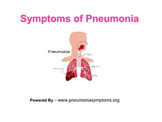 Symptoms of Pneumonia
Powered By :- www.pneumoniasymptoms.org
 