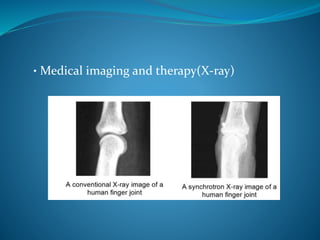• Medical imaging and therapy(X-ray) 
 