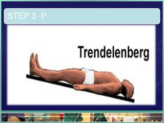 STEP 3 P
• The placement of patient in supine position with
slightly elevation of legs which helps in increase
the return of blood from the periphery.
• Clinical manifestations during syncope are
result of inadequate cerebral blood flow.
• Failure to place the victim in the supine position
may result in death or permanent neurological
damage secondary to prolonged cerebral
ischemia
• This damage occurs in as little as 2 to 3 mins if
victim maintains an upright position.
 