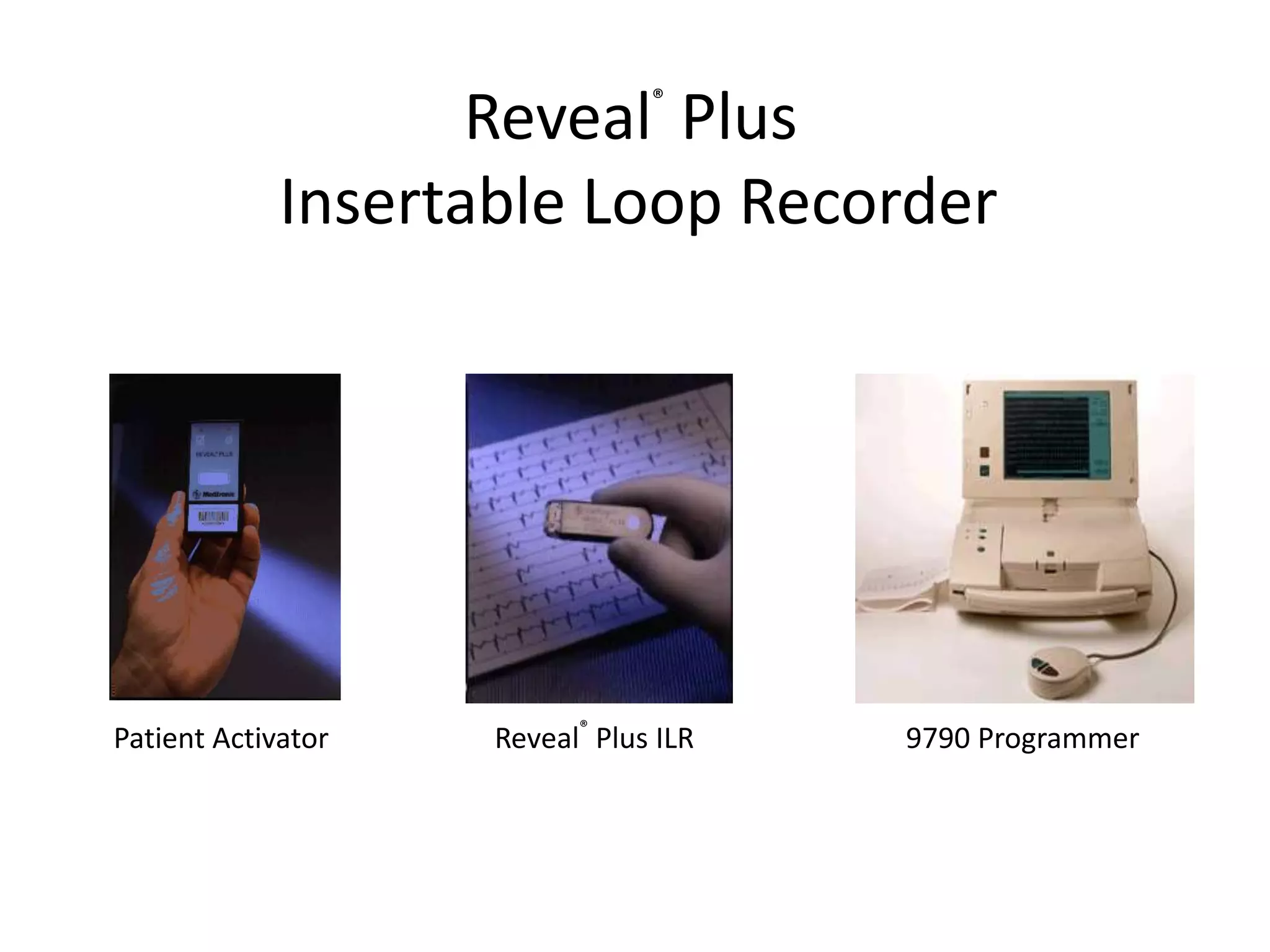 Patient Activator Reveal®
Plus ILR 9790 Programmer
Reveal®
Plus
Insertable Loop Recorder
 