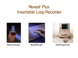 PatientActivator Reveal®
PlusILR 9790 Programmer
Reveal®
Plus
Insertable LoopRecorder
 