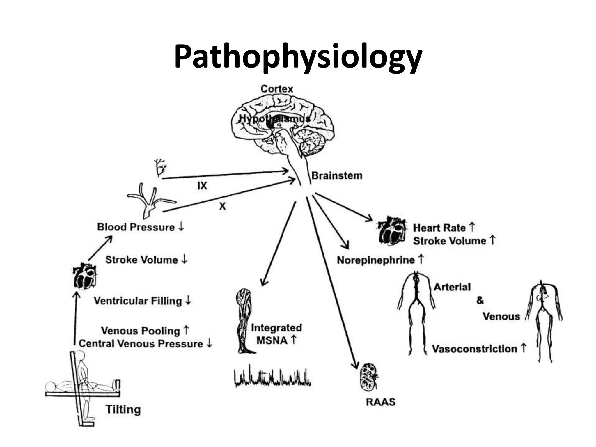 Pathophysiology
 