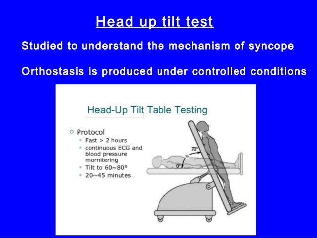 test heart tmt Syncope