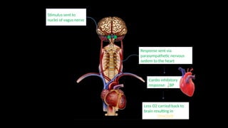 Stimulus sent to
nuclei of vagus nerve
Response sent via
parasympathetic nervous
system to the heart
Cardio inhibitory
response: BP
Less O2 carried back to
brain resulting in
‘SYNCOPE’
 