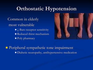 Orthostatic Hypotension Common in elderly most vulnerable ↓  Baro receptor sensitivity Reduced thirst mechanism Poly pharmacy Peripheral sympathetic tone impairment Diabetic neuropathy, antihypertensive medication 