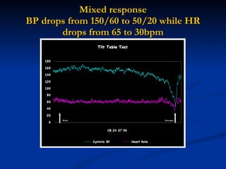 Mixed response BP drops from 150/60 to 50/20 while HR drops from 65 to 30bpm 