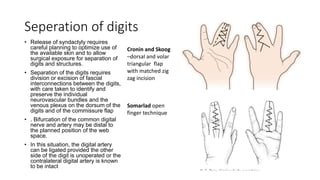 Racket Incision Digits Syndactyly Hand | PPTX