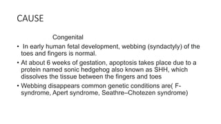 CAUSE
Congenital
• In early human fetal development, webbing (syndactyly) of the
toes and fingers is normal.
• At about 6 weeks of gestation, apoptosis takes place due to a
protein named sonic hedgehog also known as SHH, which
dissolves the tissue between the fingers and toes
• Webbing disappears common genetic conditions are( F-
syndrome, Apert syndrome, Seathre–Chotezen syndrome)
 