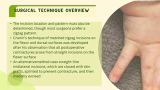 Dorsal Racket Incision SYNDACTYLY RELEASE..pptx