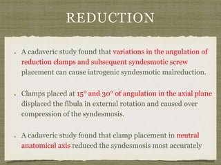 REDUCTION 
A cadaveric study found that variations in the angulation of 
reduction clamps and subsequent syndesmotic screw 
placement can cause iatrogenic syndesmotic malreduction. 
Clamps placed at 15° and 30° of angulation in the axial plane 
displaced the fibula in external rotation and caused over 
compression of the syndesmosis. 
A cadaveric study found that clamp placement in neutral 
anatomical axis reduced the syndesmosis most accurately 
 