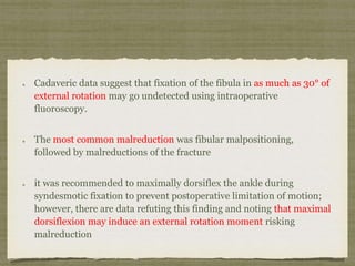 Cadaveric data suggest that fixation of the fibula in as much as 30° of 
external rotation may go undetected using intraoperative 
fluoroscopy. 
The most common malreduction was fibular malpositioning, 
followed by malreductions of the fracture 
it was recommended to maximally dorsiflex the ankle during 
syndesmotic fixation to prevent postoperative limitation of motion; 
however, there are data refuting this finding and noting that maximal 
dorsiflexion may induce an external rotation moment risking 
malreduction 
 
