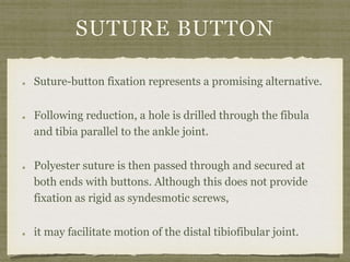 SUTURE BUTTON 
Suture-button fixation represents a promising alternative. 
Following reduction, a hole is drilled through the fibula 
and tibia parallel to the ankle joint. 
Polyester suture is then passed through and secured at 
both ends with buttons. Although this does not provide 
fixation as rigid as syndesmotic screws, 
it may facilitate motion of the distal tibiofibular joint. 
 