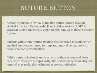 SUTURE BUTTON 
A recent systematic review found that suture-button fixation 
yielded American Orthopaedic Foot & Ankle Society (AOFAS) 
scores at twelve and twenty-eight months similar to those for screw 
fixation. 
Patients with suture-button fixation also returned to work earlier 
and had less frequent need for implant removal compared with 
those who had screw fixation. 
While a suture button is more expensive than screws and lacks 
conclusive evidence of superiority, the decreased need for surgical 
removal may make this technique more cost-effective 
 
