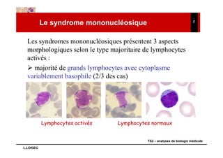 Le syndrome mononucléosique                                 2




  Les syndromes mononucléosiques présentent 3 aspects
  morphologiques selon le type majoritaire de lymphocytes
  activés :
     majorité de grands lymphocytes avec cytoplasme
  variablement basophile (2/3 des cas)




           Lymphocytes activés   Lymphocytes normaux


                                           TS2 – analyses de biologie médicale

L.LOKIEC
 