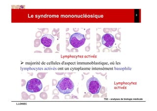 Le syndrome mononucléosique                                    3




                       Lymphocytes activés
    majorité de cellules d'aspect immunoblastique, où les
  lymphocytes activés ont un cytoplasme intensément basophile


                                                       Lymphocytes
                                                       activés

                                              TS2 – analyses de biologie médicale

L.LOKIEC
 