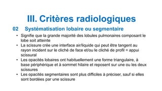 III. Critères radiologiques
• Signifie que la grande majorité des lobules pulmonaires composant le
lobe soit atteinte
• La...