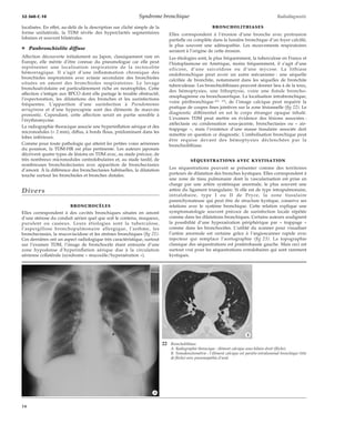 32-360-C-10 Syndrome bronchique Radiodiagnostic 
localisées. En effet, au-delà de la description sur cliché simple de la 
forme unilatérale, la TDM révèle des hyperclartés segmentaires 
lobaires et souvent bilatérales. 
¦ Panbronchiolite diffuse 
Affection découverte initialement au Japon, classiquement rare en 
Europe, elle mérite d’être connue du pneumologue car elle peut 
représenter une localisation respiratoire de la rectocolite 
hémorragique. Il s’agit d’une inflammation chronique des 
bronchioles respiratoires avec ectasie secondaire des bronchioles 
situées en amont des bronchioles respiratoires. Le lavage 
bronchoalvéolaire est particulièrement riche en neutrophiles. Cette 
affection s’intègre aux BPCO dont elle partage le trouble obstructif, 
l’expectoration, les dilatations des bronches et les surinfections 
fréquentes. L’apparition d’une surinfection à Pseudomonas 
aeruginosa et d’une hypercapnie sont des éléments de mauvais 
pronostic. Cependant, cette affection serait en partie sensible à 
l’érythromycine. 
La radiographie thoracique associe une hyperinflation aérique et des 
micronodules (< 2 mm), diffus, à bords flous, prédominant dans les 
lobes inférieurs. 
Comme pour toute pathologie qui atteint les petites voies aériennes 
du poumon, la TDM-HR est plus pertinente. Les auteurs japonais 
décrivent quatre types de lésions en TDM avec, au stade précoce, de 
très nombreux micronodules centrolobulaires et, au stade tardif, de 
nombreuses bronchiolectasies avec apparition de bronchectasies 
d’amont. À la différence des bronchectasies habituelles, la dilatation 
touche surtout les bronchioles et bronches distales. 
Divers 
BRONCHOCÈLES 
Elles correspondent à des cavités bronchiques situées en amont 
d’une sténose du conduit aérien quel que soit le contenu, muqueux, 
purulent ou caséeux. Leurs étiologies sont la tuberculose, 
l’aspergillose bronchopulmonaire allergique, l’asthme, les 
bronchectasies, la mucoviscidose et les atrésies bronchiques (fig 21). 
Ces dernières ont un aspect radiologique très caractéristique, surtout 
sur l’examen TDM, l’image de bronchocèle étant entourée d’une 
zone hypodense d’hyperinflation aérique due à la circulation 
aérienne collatérale (syndrome « mucocèle/hyperaération »). 
BRONCHOLITHIASES 
Elles correspondent à l’érosion d’une bronche avec protrusion 
partielle ou complète dans la lumière bronchique d’un foyer calcifié, 
le plus souvent une adénopathie. Les mouvements respiratoires 
seraient à l’origine de cette érosion. 
Les étiologies sont, le plus fréquemment, la tuberculose en France et 
l’histoplasmose en Amérique, moins fréquemment, il s’agit d’une 
silicose, d’une sarcoïdose ou d’une mycose. La lithiase 
endobronchique peut avoir un autre mécanisme : une séquelle 
calcifiée de bronchite, notamment dans les séquelles de bronchite 
tuberculeuse. Les bronchiolithiases peuvent donner lieu à de la toux, 
des hémoptysies, une lithoptysie, voire une fistule broncho-oesophagienne 
ou bronchoaortique. La localisation intrabronchique, 
voire péribronchique [22, 25], de l’image calcique peut requérir la 
pratique de coupes fines jointives sur la zone lésionnelle (fig 22). Le 
diagnostic différentiel en est le corps étranger opaque inhalé. 
L’examen TDM peut mettre en évidence des lésions associées : 
atélectasie ou condensation sous-jacente, bronchectasies ou « air-trappage 
», mais l’existence d’une masse tissulaire associée doit 
remettre en question ce diagnostic. L’embolisation bronchique peut 
être requise devant des hémoptysies déclenchées par la 
bronchiolithiase. 
SÉQUESTRATIONS AVEC KYSTISATION 
Les séquestrations peuvent se présenter comme des territoires 
porteurs de dilatation des bronches kystiques. Elles correspondent à 
une zone de tissu pulmonaire dont la vascularisation est prise en 
charge par une artère systémique anormale, le plus souvent une 
artère du ligament triangulaire. Si elle est de type intrapulmonaire, 
intralobaire, type I ou II de Pryce, la zone tissulaire 
parenchymateuse qui peut être de structure kystique, conserve ses 
relations avec le système bronchique. Cette relation explique une 
symptomatologie souvent précoce de surinfection locale répétée 
comme dans les dilatations bronchiques. Certains auteurs soulignent 
la possibilité d’une hyperaération périphérique par « trappage » 
comme dans les bronchocèles. L’utilité du scanner pour visualiser 
l’artère anormale est certaine grâce à l’angioscanner rapide avec 
injecteur qui remplace l’aortographie (fig 23). La topographie 
classique des séquestrations est postérobasale gauche. Mais ceci est 
surtout vrai pour les séquestrations extralobaires qui sont rarement 
kystiques. 
22 Broncholithiase. 
A. Radiographie thoracique : élément calcique sous-hilaire droit (flèche). 
B. Tomodensitométrie : l’élément calcique est pariéto-intraluminal bronchique (tête 
de flèche) avec pneumopathie d’aval. 
*A 
*B 
14 
 