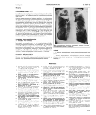 Radiodiagnostic SYNDROME CAVITAIRE 32-360-H-10 
Divers 
Emphysème bulleux (fig 2) 
Les bulles peuvent compliquer tous les types d’emphysème. Ce sont des 
cavités de plus de 1 cm de diamètre, souvent volumineuses, cernées par 
un fin liseré. 
Elles sont uniques ou multiples, localisées ou diffuses. Ces bulles peuvent 
être réséquées pour diminuer l’hyperpression transthoracique et améliorer 
ainsi l’hémodynamique pulmonaire et cardiaque, ainsi que l’efficacité 
diaphragmatique. La radiographie joue un rôle important dans l’indication 
opératoire [35]. Elle permet d’apprécier : le volume des bulles, les signes de 
compression sur le parenchyme, le refoulement des vaisseaux, des hiles, 
du coeur et du médiastin, les signes d’hypertension artérielle pulmonaire, 
l’évolutivité des lésions. La radiographie permet également de dépister des 
complications : pneumothorax, infection responsable d’un niveau 
hydroaérique (fig 28) ou du comblement de la bulle, beaucoup plus 
rarement hémorragie et cancérisation. LaTDMcomplète la radiographie : 
elle apprécie bien la topographie et le volume des bulles, leur caractère 
compressif ou non et l’état du parenchyme non bulleux. Elle a remplacé 
les autres méthodes d’imagerie dans le bilan préopératoire [11]. 
Dysplasie bronchopulmonaire 
ou maladie des ventilés 
La dysplasie bronchopulmonaire est une complication possible des 
détresses respiratoires néonatales sévères traitées par ventilation 
assistée. Sa pathogénie complexe fait intervenir de multiples facteurs 
parmi lesquels la prématurité, une ventilation précoce en pression 
positive, une oxygénothérapie prolongée. L’image radiographique est 
faite de larges bulles et d’opacités en bandes [73]. Dans les cas d’évolution 
favorable, l’image radiographique revient lentement à la normale. 
Inhalation d’hydrocarbure 
Elle peut être responsable de pneumatocèles d’apparition retardée au 
sein d’un foyer pneumonique. Elles disparaissent sans séquelle. 
28 Emphysème bulleux. Surinfection responsable de l’apparition d’un niveau 
hydroaérique dans une bulle du sommet droit. 
Autres 
– Un infarctus pulmonaire non infecté peut exceptionnellement être 
excavé. 
– Certaines pneumopathies médicamenteuses peuvent rarement 
s’excaver. Une atteinte cavitaire due à la bléomycine a récemment été 
rapportée [72]. 
Références 
[1] Aberle DR, Gamsu G, Linch D. Thoracic manifesta-tions 
of Wegener granulomatosis: diagnosis and 
course. Radiology 1990 ; 174 : 703-709 
[2] Albelda SM, Kern JA, Marinelli DL, Miller WT. Expand-ing 
spectrum of pulmonary disease caused by non-tuberculous 
mycobacteria. Radiology 1985 ; 157 : 
289-296 
[3] Balikian JP, Herman PG. Non-Hodgkin lymphoma of 
the lungs. Radiology 1979 ; 132 : 569-576 
[4] Balikian JP, Mudarri FF. Hydatid disease of the lungs: a 
roentgenologic study of 50 cases. Am J Roentgenol 
1974 ; 122 : 692-707 
[5] Bancks N, Zornoza J. Pseudocavitary granulomas of 
the lung. Am J Roentgenol 1976 ; 127 : 251-252 
[6] Bayer AS. Fungal pneumonias : pulmonary coccidioi-dal 
syndromes. Chest 1981 ; 79 : 686-691 
[7] Beggs I. The radiology of hydatid disease. Am J 
Roentgenol 1985 ; 145 : 639-648 
[8] Berkmen YM. The many faces of bronchiolo-alveolar 
carcinoma. Semin Roentgenol 1977 ; 12 : 207-214 
[9] Brauner MW, Grenier P, Mouelhi MM, Mompoint D, Le-noir 
S. Pulmonary histiocytosis X: evaluation with high-resolution 
CT. Radiology 1989 ; 172 : 255-258 
[10] Bronnimann DA, Adam RD, Galgiani JN et al. Coccidi-oidomycosis 
in the acquired immunodeficiency syn-drome. 
Ann Intern Med 1987 ; 106 : 372-379 
[11] Carr DH, Pride NB. Computed tomography in preope-rative 
assessment of bullous emphysema. Clin Radiol 
1984 ; 35 : 43-45 
[12] Chaudhuri MR. Primary pulmonary cavitating carcino-mas. 
Thorax 1973 ; 28 : 354-366 
[13] Christensen EE, Dietz GW, Ahn CH et al. Pulmonary 
manifestations of Mycobacterium intracellularis. Am J 
Roentgenol 1979 ; 133 : 59-66 
[14] Christensen EE, Dietz GW, Ahn CH, Chapman JS, 
Murry RC, Hurst GA. Radiographic manifestations of 
pulmonary Mycobacterium kansasii infections. Am J 
Roentgenol 1978 ; 131 : 985-993 
[15] Chuck SL, Sande MA. Infections with Cryptococcus 
neoformans in the acquired immunodeficiency syn-drome. 
N Engl J Med 1989 ; 321 : 794-799 
[16] Cohen JR, Amorosa JK, Smith PR. The air fluid level in 
cavitary pulmonary tuberculosis. Radiology 1978 ; 
127 : 315-316 
[17] Delorenzo LJ, Huang CT, Stone DJ. Roentgenographic 
patterns of Pneumocystis carinii pneumonia in 104 pa-tients 
with AIDS. Chest 1987 ; 91 : 323-326 
[18] Feigin DS. Pulmonary cryptococcosis : radiologic-pathologic 
correlates of its three forms. Am J 
Roentgenol 1983 ; 141 : 1263-1272 
[19] Feigin DS. Nocardiosis of the lung : chest radiographic 
findings in 21 cases. Radiology 1986 ; 159 : 9-14 
[20] Felker RE, Tonkin IL. Imaging of pulmonary sequestra-tion. 
Am J Roentgenol 1990 ; 154 : 241-249 
[21] Felson B. Pulmonary sequestration revesited. Med Ra-diogr 
Photogr 1988 ; 64 : 1-27 
[22] Felson B, Wiot JF. Some less familiar roentgen mani-festations 
of carcinoma of the lung. Semin Roentgenol 
1977 ; 12 : 187-206 
[23] Feuerstein IM, Archer A, Pluda JM et al. Thin-walled 
cavities, cysts and pneumothorax in Pneumocystis 
carinii pneumonia : further observations with histo-pathologic 
correlation. Radiology 1990 ; 174 : 697-702 
[24] Forrest JV. Common fungal diseases of the lungs II. 
Histoplasmosis. Radiol Clin North Am 1973 ; 11 : 
163-168 
[25] Fraser RG, Pare JA. Roentgenologic signs in the diag-nosis 
of chest disease. In : Diagnosis of diseases of 
the chest. Philadelphia :WB Saunders, 1989 : 580-587 
[26] Fraser RG, Pare JA. Pulmonary abnormalities of deve-lopmental 
origin. In : Diagnosis of diseases of the 
chest. Philadelphia : WB Saunders, 1989 : 695-773 
[27] Fraser RG, Pare JA. Secondary neoplasms of the lung. 
In : Diagnosis of diseases of the chest. Philadelphia : 
WB Saunders, 1989 : 1628-1632 
[28] Gefter WB, Albelda SM, Talbot GH et al. Invasive pul-monary 
aspergillosis and acute leukemia. Limitations 
in the diagnostic utility of the air crescent sign. 
Radiology 1985 ; 157 : 605-610 
[29] Gefter WB, Weingrad TR, Epstein DM et al. « Semi-invasive 
» pulmonary aspergillosis. Radiology 1981 ; 
140 : 313-321 
[30] Giron J, Sans N, Poey C, Fajadet P, Fourcade D, Se-nac 
JP et al. Traitement percutané radiologique des as-pergillomes 
pulmonaires inopérables. À propos de 
42 cas. J Radiol 1998 ; 79 : 139-145 
[31] Glickstein M, Kornstein MJ, Pietra GG, Aronchick JM, 
Gefter WB, Epstein DM et al. Non lymphomatous lym-phoid 
disorders of the lung. Am J Roentgenol 1986 ; 
147 : 227-237 
[32] Goodman PC. Pulmonary tuberculosis in patients with 
Ima-ging 
acquired immunodeficiency syndrome. J Thorax 1990 ; 5 : 38-45 
[33] Greene R. The pulmonary aspergillosis: three distinct 
entities or a spectrum of disease. Radiology 1981 ; 
140 : 527-530 
[34] Grenier P, Bletry O, Cornud F, Godeau P, Nahum H. 
Pulmonary involvement in Behçet disease. Am J 
Roentgenol 1981 ; 137 : 565-569 
[35] Grenier P, Touaty E, Pariente R, Nahum H. Emphy-sème 
panlobulaire. Apport de la radiologie dans l’indi-cation 
opératoire. J Radiol 1980 ; 61 : 693-698 
[36] Gross BH, Felson B, Birnberg FA. The respiratory tract 
in amyloidosis and the plasma cell dyscrasias. Semin 
Roentgenol 1986 ; 21 : 113-127 
[37] Gross BH, Spitz HB, Felson B. The mural nodule in 
cavitary opportunistic pulmonary aspergillosis. 
Radiology 1982 ; 143 : 619-622 
[38] Gurney JW, Bates FT. Pulmonary cystic disease: com-parison 
of Pneumocystis carinii pneumatoceles and 
bullous emphysema due to intravenous drug abuse. 
Radiology 1989 ; 173 : 27-31 
page 15 
 