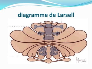 diagramme de Larsell
 