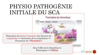 Exposition du facteur tissulaire aux facteurs de
coagulation => Activation de la coagulation =>
Formation de « Thrombine »
Sous l’effet de la thrombine le
Fibrinogène => Fibrine
2016
 