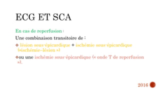 En cas de reperfusion :
Une combinaison transitoire de :
 lésion sous-épicardique + ischémie sous-épicardique
(«ischémie–lésion »)
ou une ischémie sous-épicardique (« onde T de reperfusion
»).
2016
 