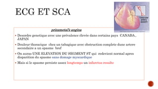 prinzmetal’s angina
 Desordre genetique avec une prévalence élevée dans certains pays CANADA ,
JAPAN
 Douleur thoracique chez un tabagique avec obstruction complete dune artere
secondaire a un spasme bref
 On auras UNE ELEVATION DU SEGMENT ST qui redevient normal apres
disparition du spasme sans domage myocardique
 Mais si le spasme persiste assez longtemps un infarctus resulte
 